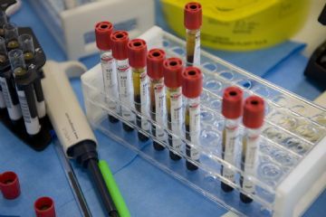 Provette per analisi del sangue con tappo rosso, disposte in un portaprovette trasparente su un banco di laboratorio, con strumenti da laboratorio sullo sfondo.