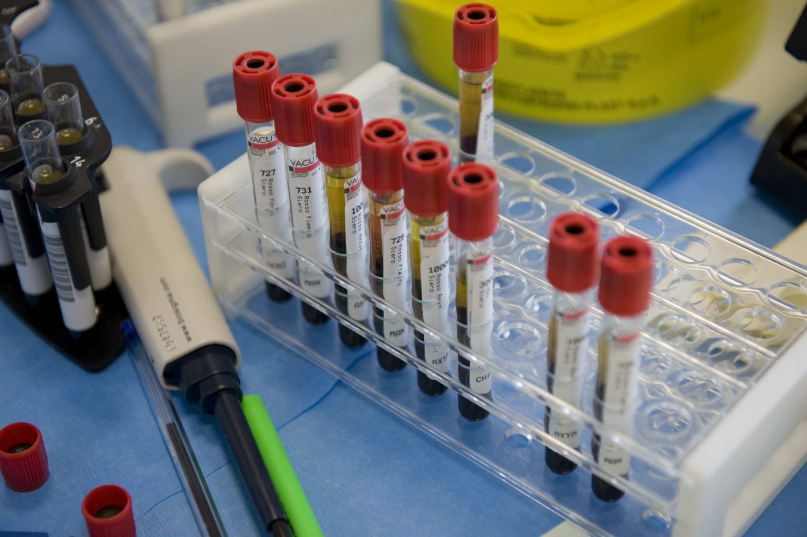 Provette per analisi del sangue con tappo rosso, disposte in un portaprovette trasparente su un banco di laboratorio, con strumenti da laboratorio sullo sfondo.